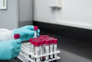 The importance of relevant testing of CBD and driving ban inconsistency